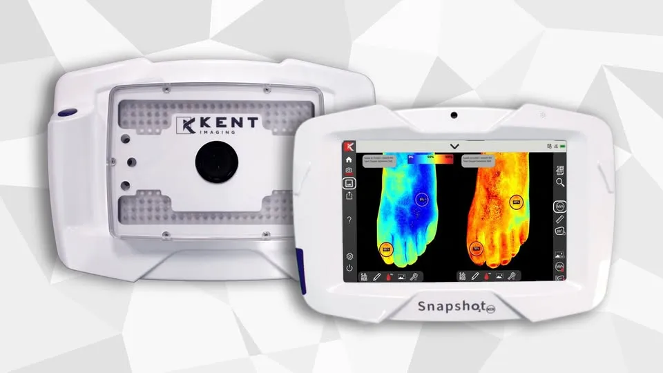 SnapshotNIR handheld near-infrared medical imaging device — medical product design by Creative Coefficient for Kent Imaging