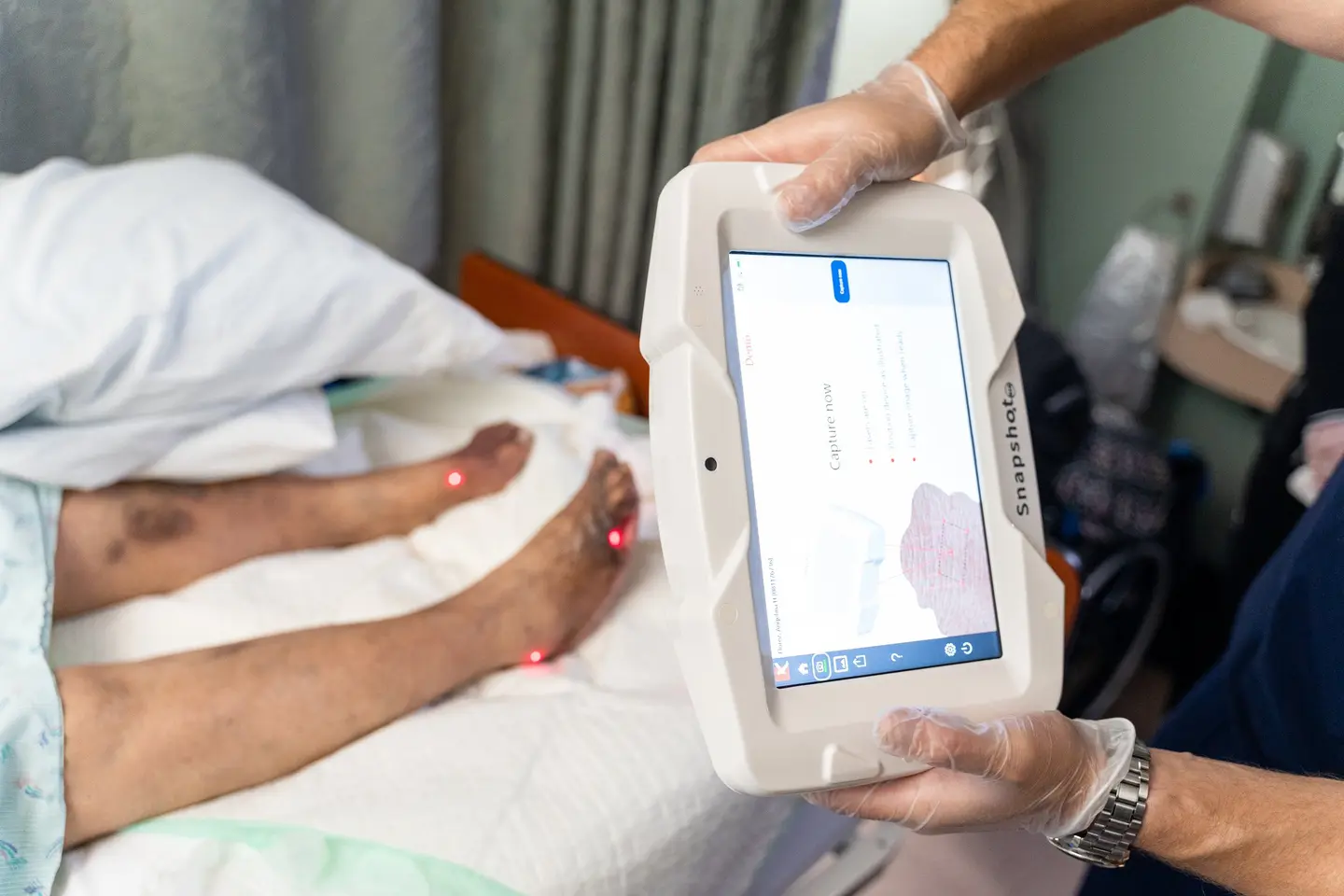 SnapshotNIR handheld device in use — near-infrared wound care imaging medical design