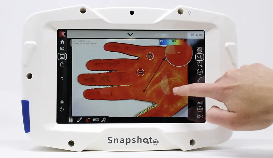 SnapshotNIR handheld NIR imager — Kent Imaging medical device design